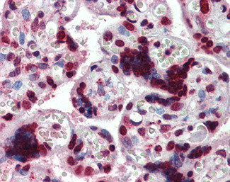 HMGA1 Antibody in Immunohistochemistry (Paraffin) (IHC (P))