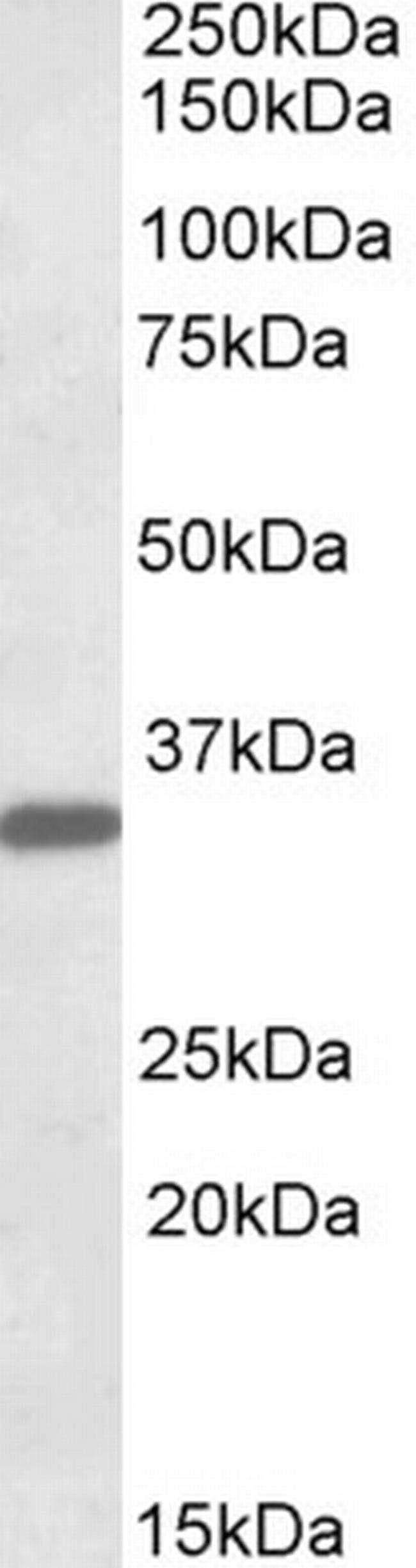 FGL1 Antibody in Western Blot (WB)