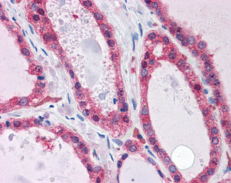 KCNN2 Antibody in Immunohistochemistry (Paraffin) (IHC (P))