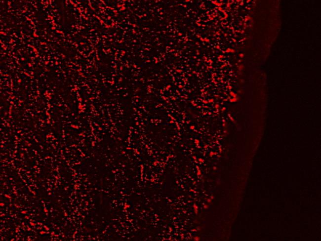 GAL Antibody in Immunohistochemistry (PFA fixed) (IHC (PFA))