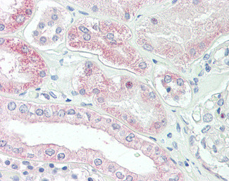 SLC4A11 Antibody in Immunohistochemistry (Paraffin) (IHC (P))