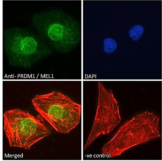 Blimp-1 Antibody in Immunocytochemistry (ICC/IF)