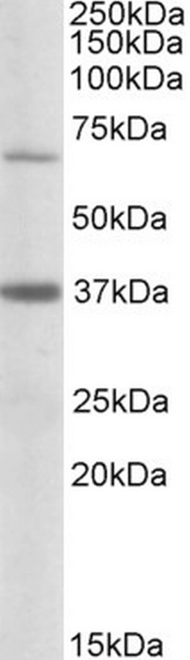 CPT2 Antibody in Western Blot (WB)