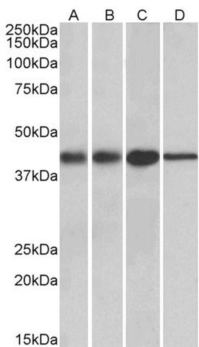 ACAT1 Antibody in Western Blot (WB)