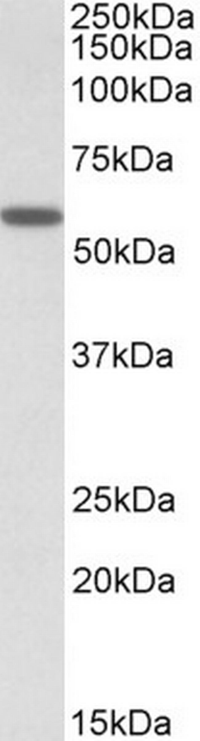 DIXDC1 Antibody in Western Blot (WB)