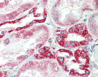 NDUFS6 Antibody in Immunohistochemistry (Paraffin) (IHC (P))