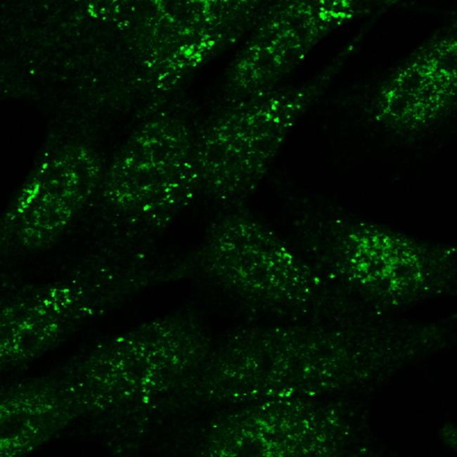 SNX1 Antibody in Immunocytochemistry (ICC/IF)