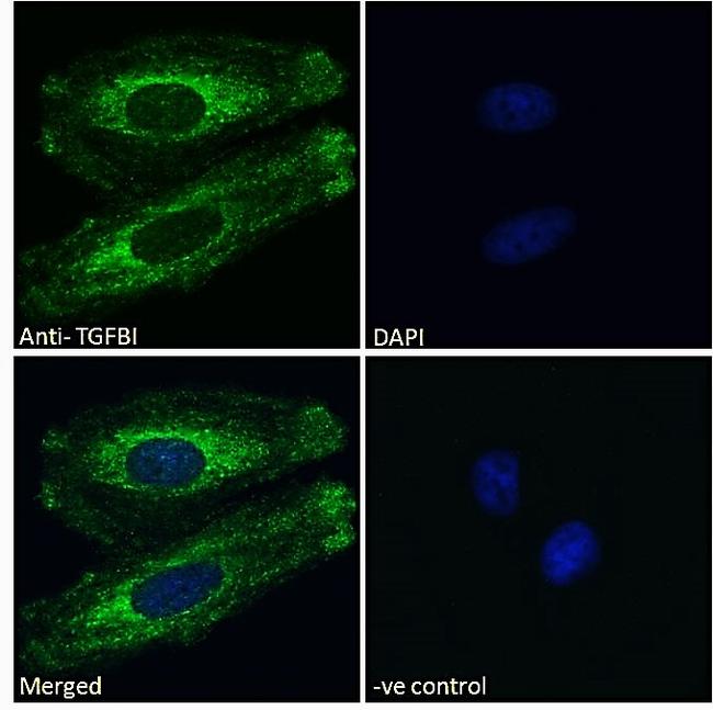 TGFBI Antibody in Immunocytochemistry (ICC/IF)