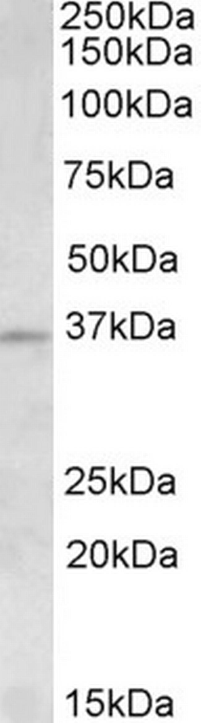 Aurora C Antibody in Western Blot (WB)