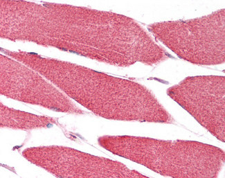 CHCHD3 Antibody in Immunohistochemistry (Paraffin) (IHC (P))