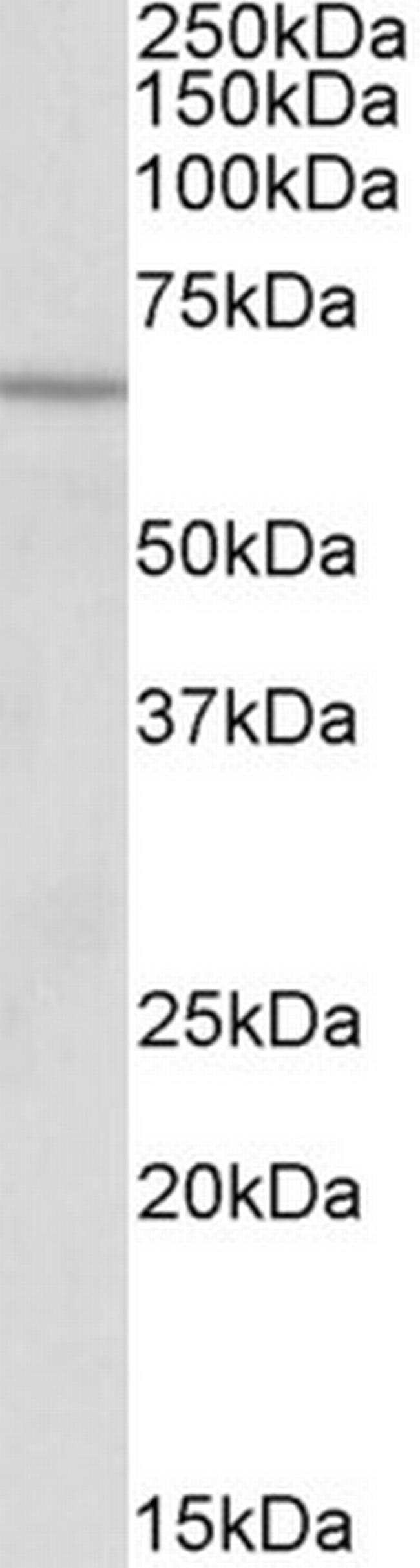 ACADVL Antibody in Western Blot (WB)