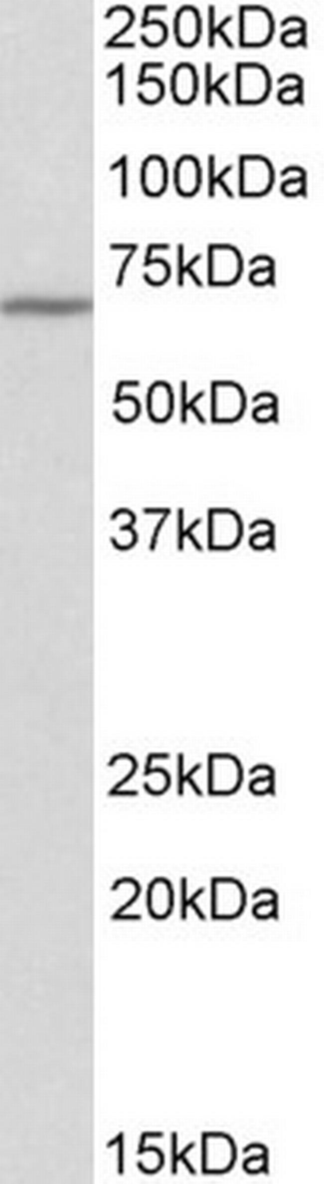 Themis Antibody in Western Blot (WB)