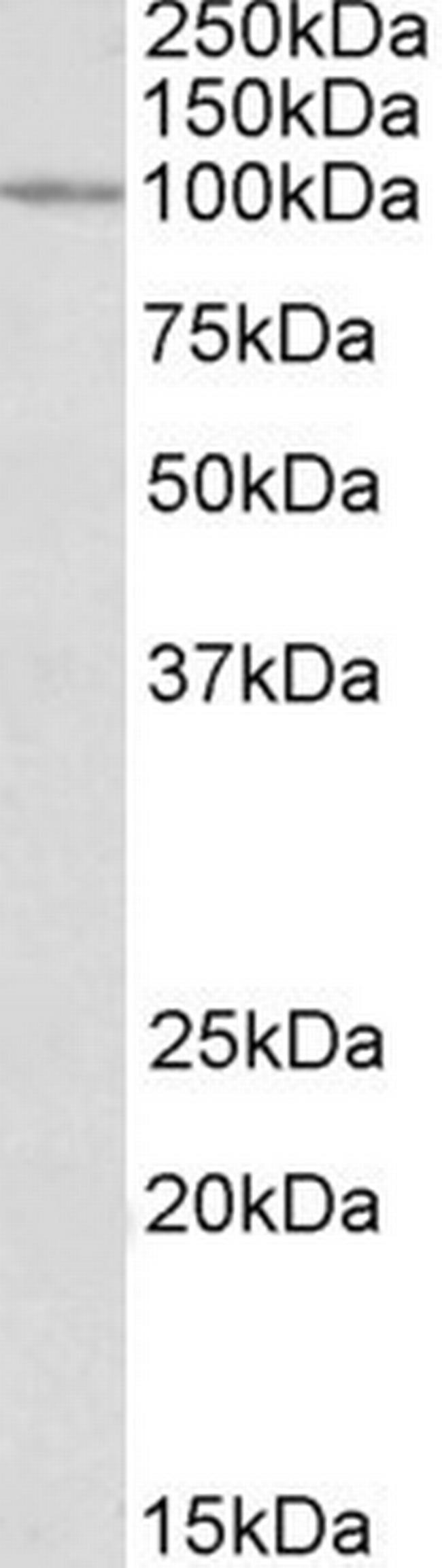 CLCN2 Antibody in Western Blot (WB)