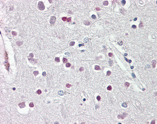 SOX3 Antibody in Immunohistochemistry (Paraffin) (IHC (P))