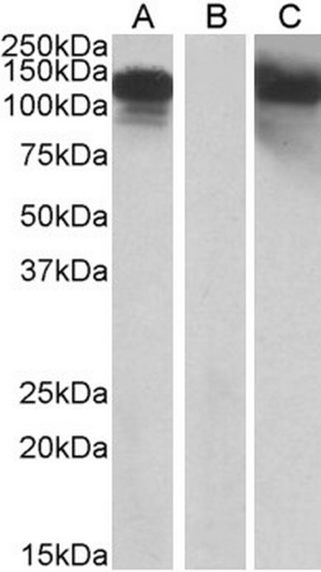 CDH11 Antibody in Western Blot (WB)