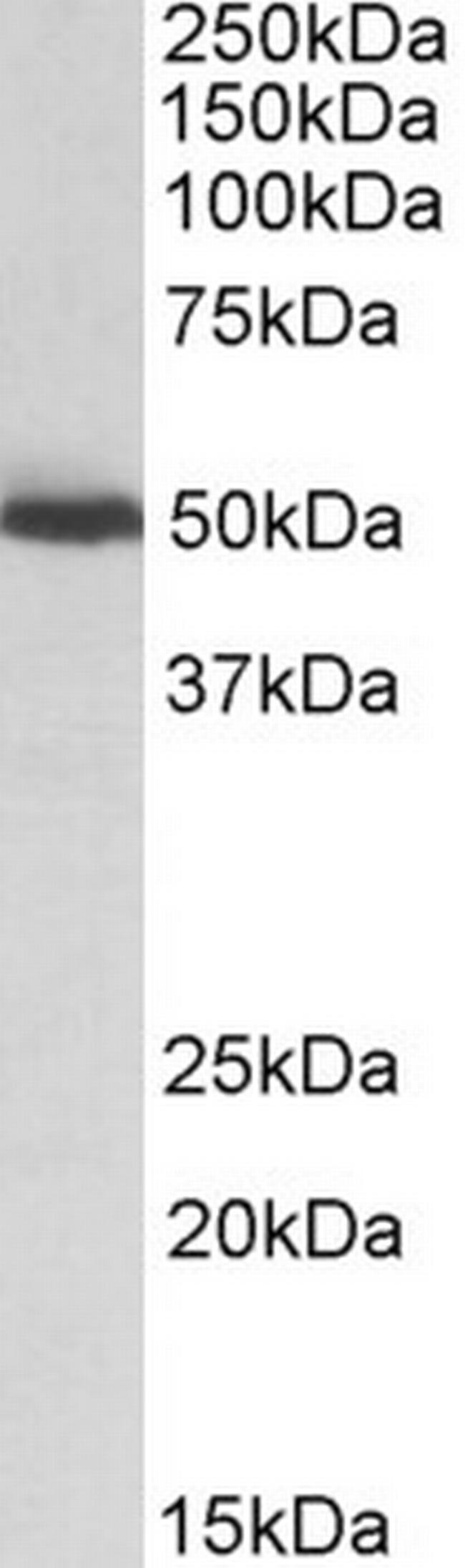 ALDH2 Antibody in Western Blot (WB)