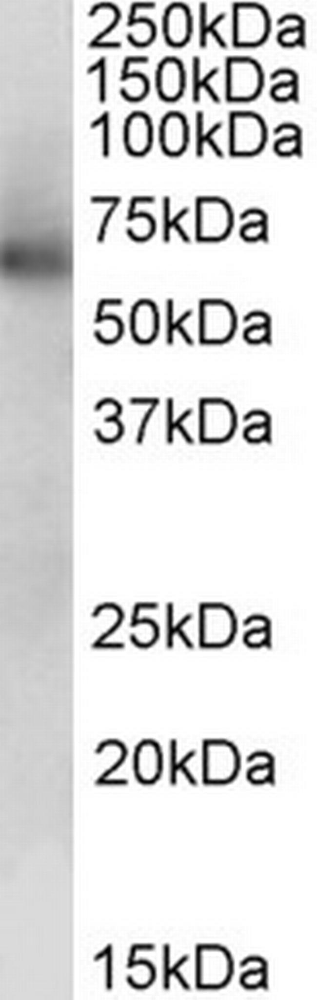 ALDH1B1 Antibody in Western Blot (WB)