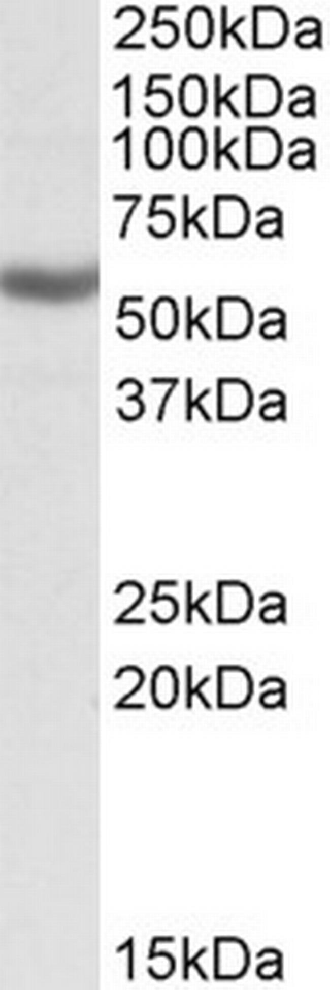 ALDH3B1 Antibody in Western Blot (WB)