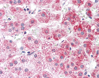 ALDH3A2 Antibody in Immunohistochemistry (Paraffin) (IHC (P))