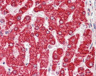 ETFB Antibody in Immunohistochemistry (Paraffin) (IHC (P))