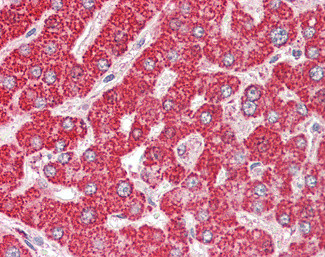 ETFB Antibody in Immunohistochemistry (Paraffin) (IHC (P))