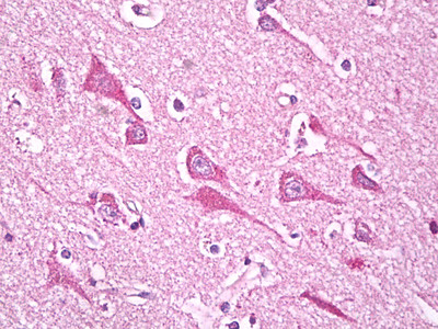 NDUFS7 Antibody in Immunohistochemistry (Paraffin) (IHC (P))