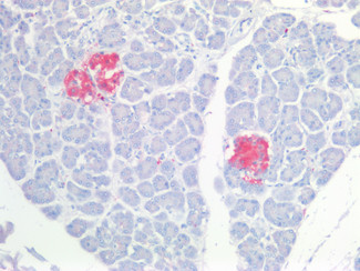 PGP9.5 Antibody in Immunohistochemistry (Paraffin) (IHC (P))