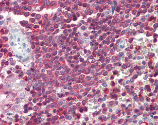 D4-GDI Antibody in Immunohistochemistry (Paraffin) (IHC (P))