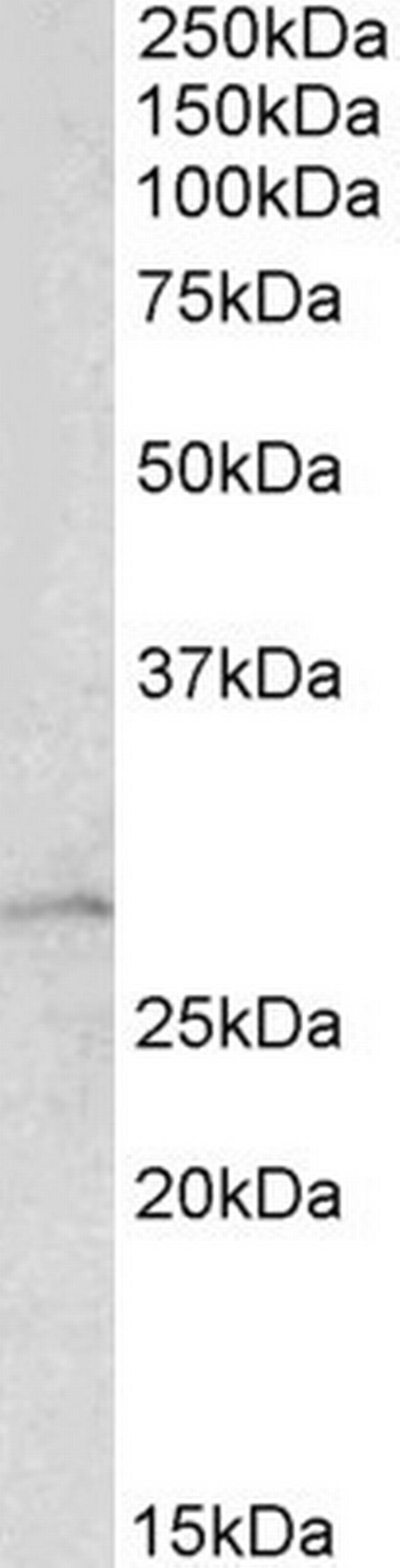 RhoGDI Antibody in Western Blot (WB)