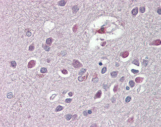 ARHGDIG Antibody in Immunohistochemistry (Paraffin) (IHC (P))