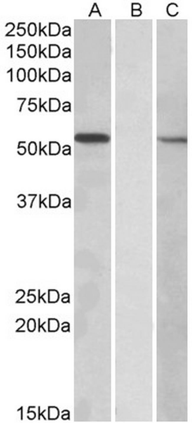 MGAT1 Antibody in Western Blot (WB)