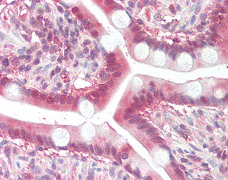 MOGAT2 Antibody in Immunohistochemistry (Paraffin) (IHC (P))