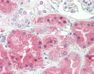 PAH Antibody in Immunohistochemistry (Paraffin) (IHC (P))