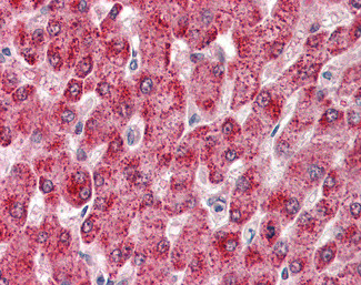 CYP2E1 Antibody in Immunohistochemistry (Paraffin) (IHC (P))