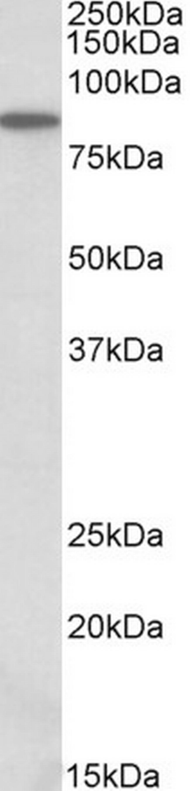 ALDH18A1 Antibody in Western Blot (WB)