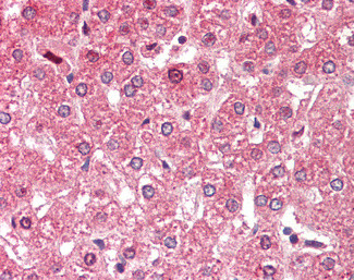 ALDH6A1 Antibody in Immunohistochemistry (Paraffin) (IHC (P))