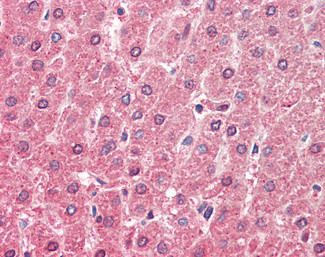 ALDH6A1 Antibody in Immunohistochemistry (Paraffin) (IHC (P))