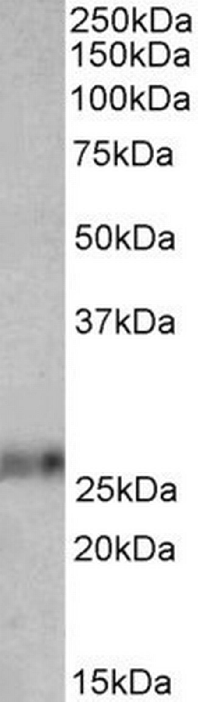 Ephrin A1 Antibody in Western Blot (WB)