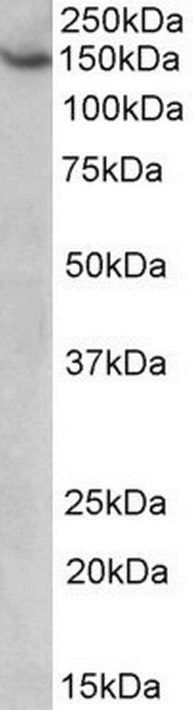 AGTPBP1 Antibody in Western Blot (WB)