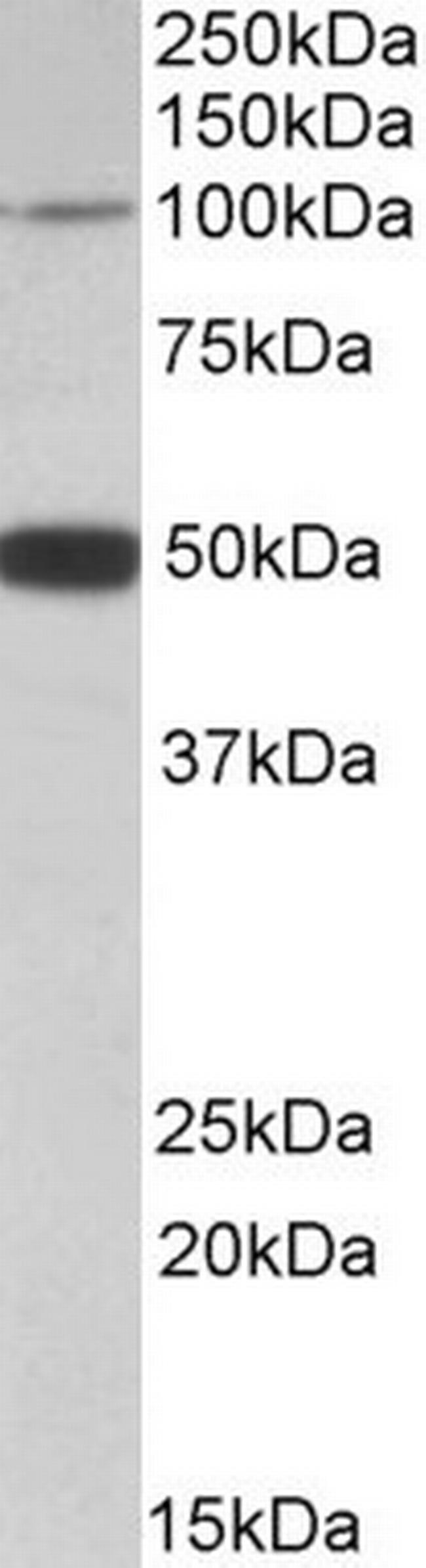 PTCHD1 Antibody in Western Blot (WB)