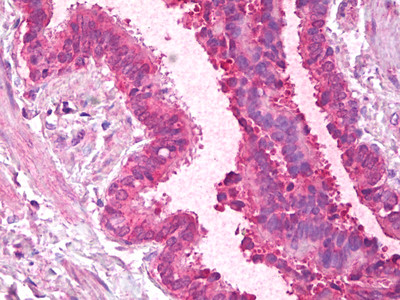 PCBP1 Antibody in Immunohistochemistry (Paraffin) (IHC (P))