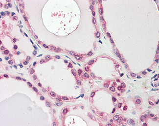 NEK7 Antibody in Immunohistochemistry (Paraffin) (IHC (P))