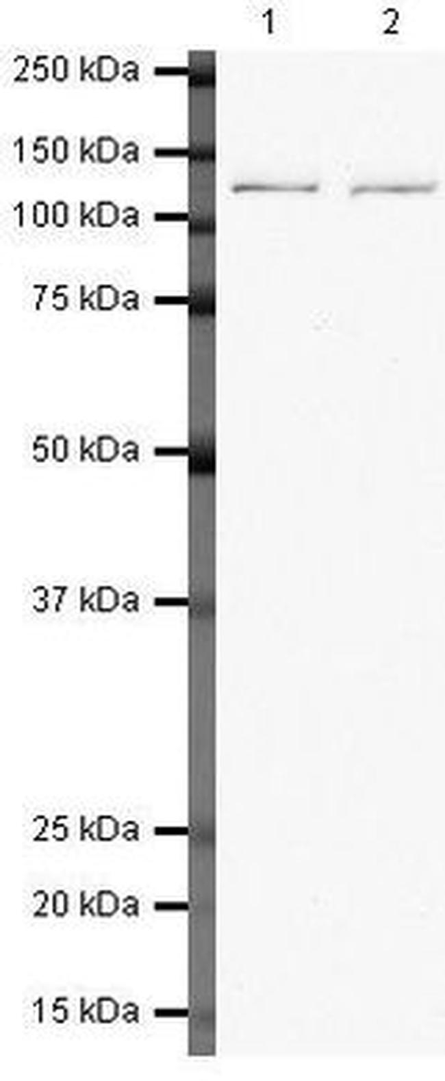 RNF20 Antibody in Western Blot (WB)