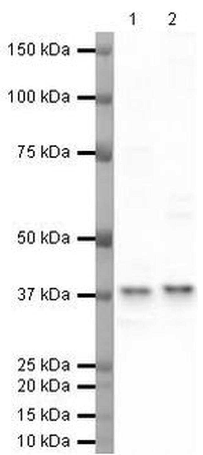 TBP Antibody in Western Blot (WB)