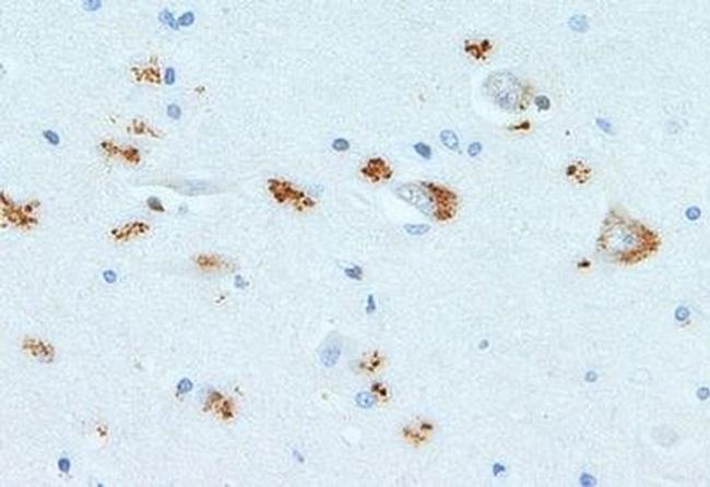 SCF Antibody in Immunohistochemistry (Paraffin) (IHC (P))