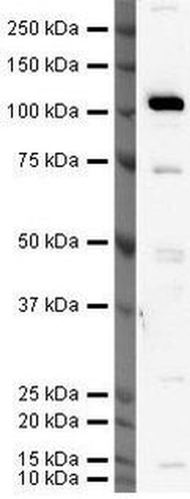 hCV-2 Antibody in Western Blot (WB)