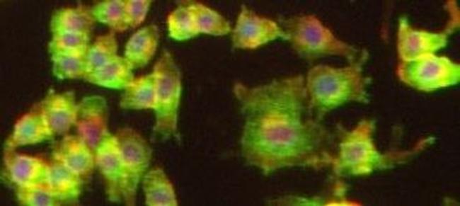 Gelsolin Antibody in Immunocytochemistry (ICC/IF)