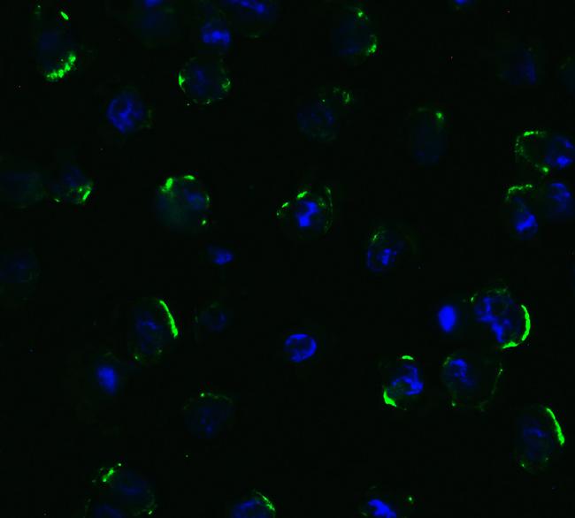 TRAIL-R2 (DR5) Antibody in Immunocytochemistry (ICC/IF)