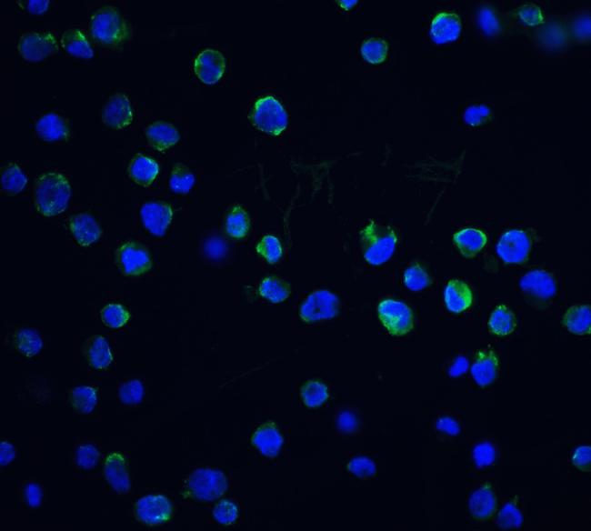 DFFB Antibody in Immunocytochemistry (ICC/IF)