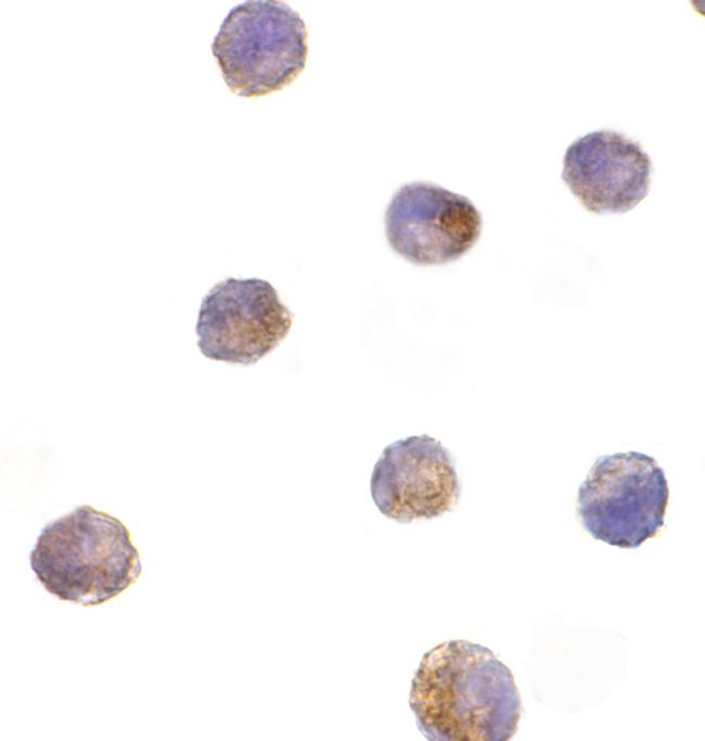 DFFB Antibody in Immunocytochemistry (ICC/IF)